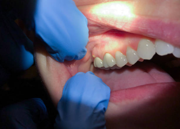 Best Weekend Emergency Dentist in Hampton, AR